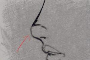 面相学之鼻子断法 之三