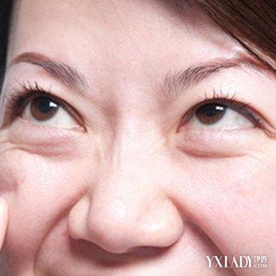 女人眼袋重是什么原因 怎样消除眼袋黑眼圈