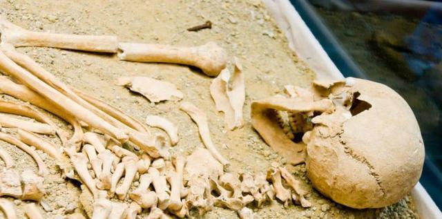 在这期间,尸体已经出现了白骨化以及身体内部多余的脂肪会包裹着骨头