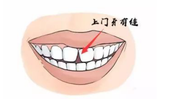 牙齿相学(牙齿影响运势?