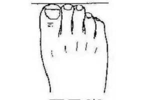 脚趾当中第二个脚趾是最长的,拥有这种脚型的人比较常见,天生的富贵命