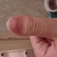 大拇指关节粗而且指甲又宽又短怎么办?