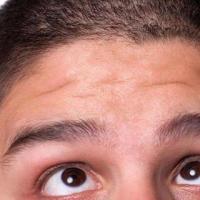 男人额头有疤痕的面相有影响吗