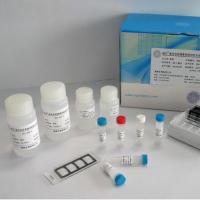 抗组蛋白dna抗体/抗二聚体dna抗体/抗心磷脂抗体elisa检测试剂盒