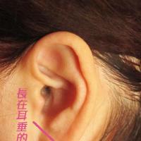 耳朵后面长痣代表什么