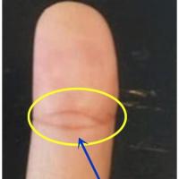 大拇指的第一指节纹线只有一条,有此手相表示着少年时家境比较的贫苦