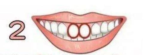 心理测试:你的牙齿是哪一种形状?测你有没有天生的富贵命!