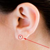 耳朵长痣面相图,不同的耳朵痣代表什么