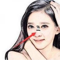 女人鼻梁有横纹面相看运势,注意出行和健康