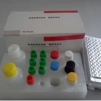 抗淋巴细胞球蛋白elisa检测试剂盒/抗骨骼肌抗体elisa检测试剂盒