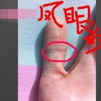 凤眼纹,手相的一种,出现在拇指,在拇指有一个完全的圆圈.