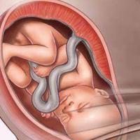 孕妇有这4种症状,就是胎儿快要出生了!_妈妈_反应_位置