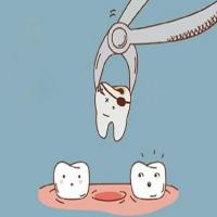 有微创拔牙技术吗?