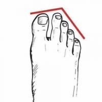 心理学:你的哪一个脚趾头比较长,测你有没有天生的富贵命,超准