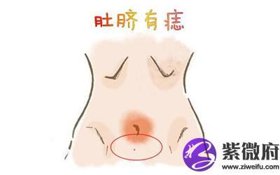 肚脐有痣的人运势好如果肚子中央肚脐的位置有痣,这样的痣被称为