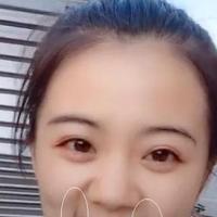 法令纹的女人面相如何