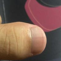 为什么有的人大拇指指甲非常短?