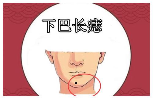 下巴长痣下巴也是面相的地库,是一个人晚年时候聚财与存钱的地方,所以